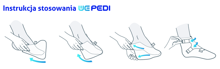 WEPedi bandaj de fixare a piciorului dimensiune L 10pcs - Imagine 3