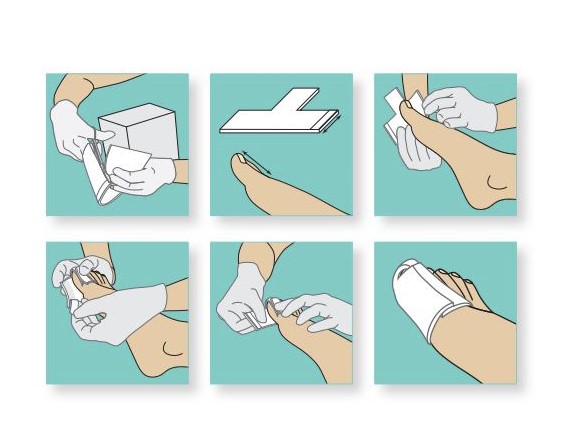 Ligasano alb sterile 14 x 10 x 0.5cm 1pc T-finger bandaj